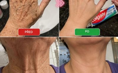 Podívejte se na to… Ty ruce vypadaly staře, plné skvrn… Více se dočtete v prvním komentáři