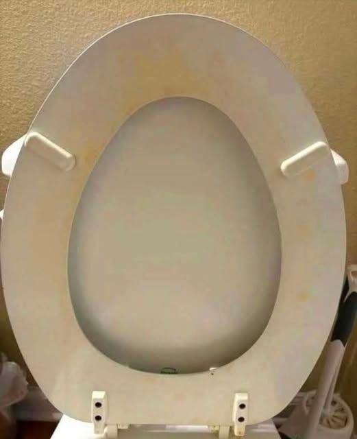 Je trapné tohle sem dávat, ale jak mám tyhle skvrny odstranit?! Zkoušela jsem čistič, jedlou sodu a ocet.