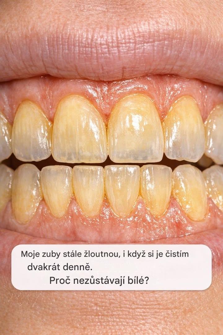 Moje zuby stále žloutnou, i když si je čistím dvakrát denně. Proč nezůstávají bílé?