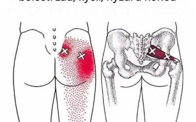Jak dosáhnout hlubokého protažení piriformis svalu pro odstranění bolesti zad, kyčlí, hýždí a nohou
