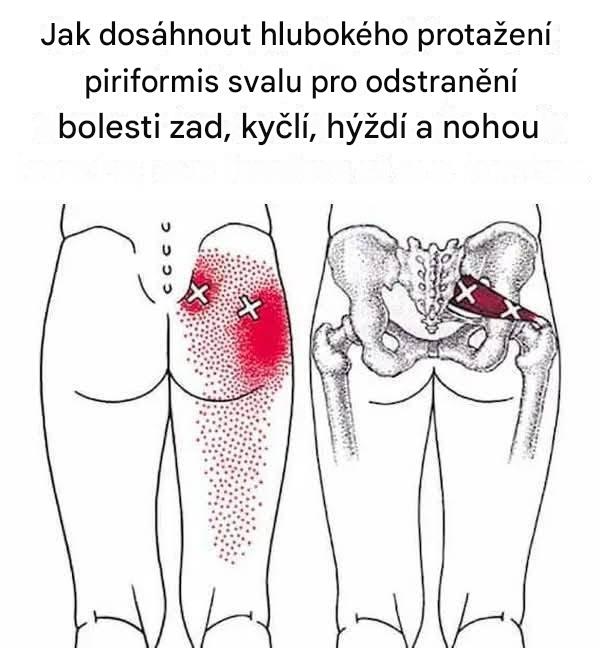 Jak dosáhnout hlubokého protažení piriformis svalu pro odstranění bolesti zad, kyčlí, hýždí a nohou