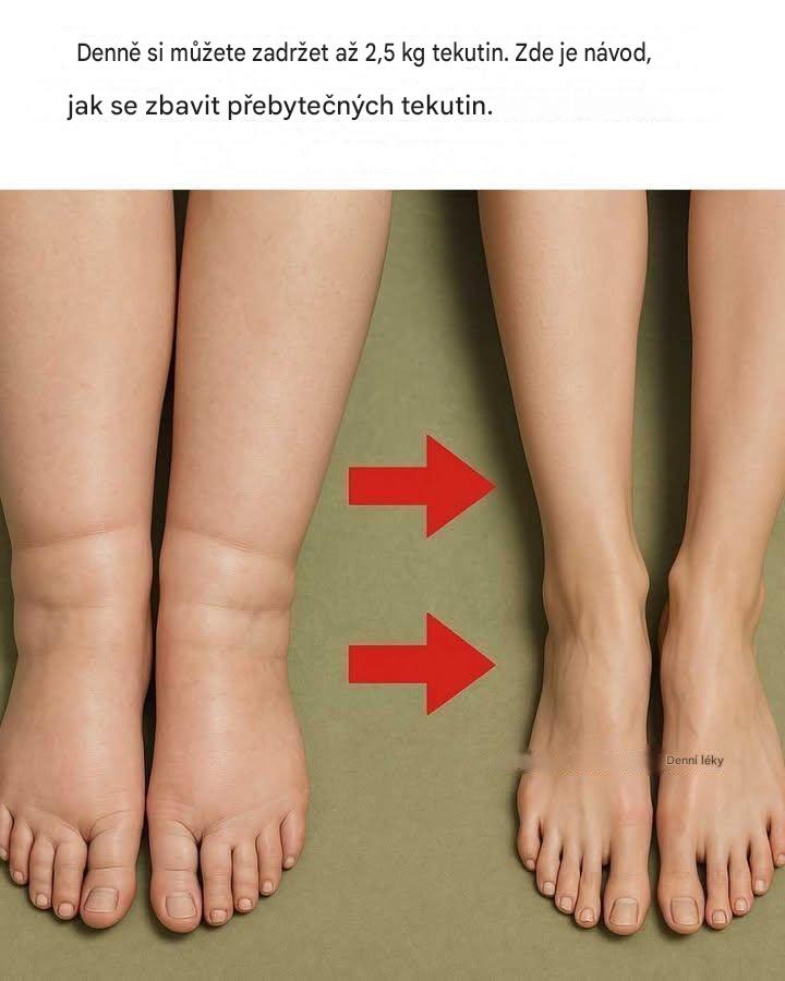 Denně si můžete zadržet až 2,5 kg tekutin. Zde je návod, jak se zbavit přebytečných tekutin.