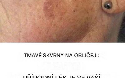 Přidejte si ho do krému a nedokonalosti na obličeji budou jen vzdálenou vzpomínkou.