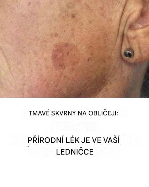 Přidejte si ho do krému a nedokonalosti na obličeji budou jen vzdálenou vzpomínkou.